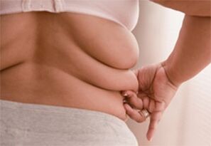 Fat Folds στις πλευρές